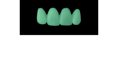 Cod.C21Facing : 15x  wax facings-bridges,  SMALL, Tapering ovoid, TOOTH 12-22, compatible with Cod.A21Lingual,TOOTH 12-22 for long-term provisionals preparation